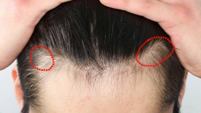 Article on Hair Treatments 