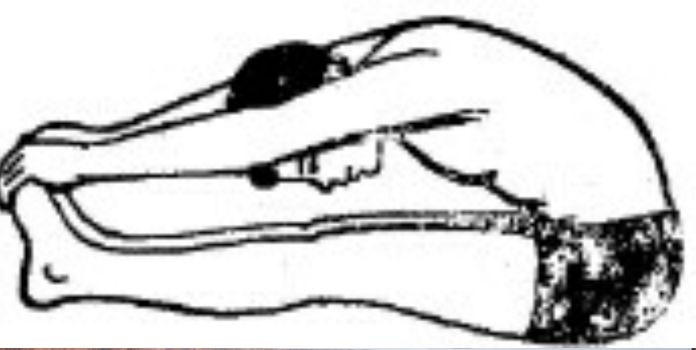 Yoga therapy for blood pressure and heart disease