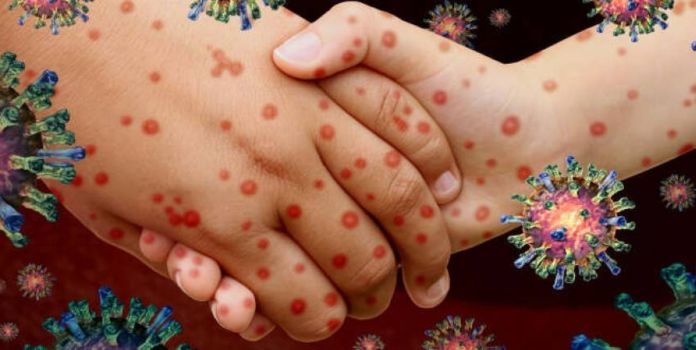 Communicable Diseases
