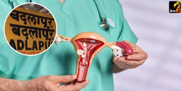 Ovary trafficking racket: बदलापूरमध्ये अंडाशय तस्करी रॅकेटचा पर्दाफाश; तीन महिला अटकेत, नेमकं प्रकरण काय?