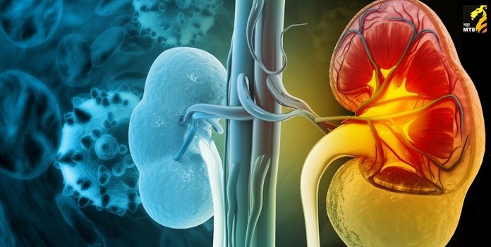  Kidney Disease