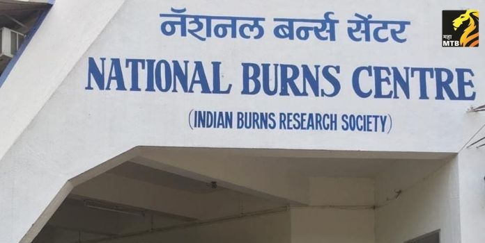 national burns centre