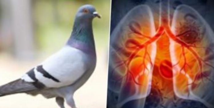 Pigeon Health Hazard